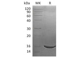 Recombinant Human ISG15/G1P2 Protein (His Tag)