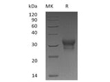 Recombinant Human IFN-λ1/IL-29 Protein (His Tag)