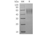 Recombinant Human ICAM-2/CD102 Protein (His Tag)