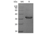 Recombinant Human IGFBP-1/IGFBP1 Protein (His Tag)