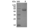 Recombinant Human ICOS/AILIM Protein (Fc Tag)