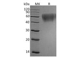 Recombinant Human ICOS Ligand/ICOSL Protein (His Tag)