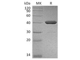 Recombinant Human IDO2 Protein (His Tag)