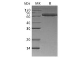 Recombinant Human ROR1 Protein (His Tag)