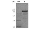 Recombinant Human ROR1 Protein (Fc Tag)