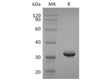 Recombinant Human IgG4-Fc Protein (aa 99-326)