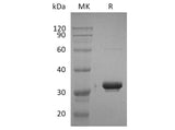 Recombinant Human IgG2-Fc Protein (aa 99-326, Val161Met)