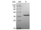 Recombinant Human IgG2-Fc Protein (aa 104-326, Val161Met)