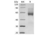 Recombinant Human HVEM/TNFRSF14 Protein (mFc Tag)