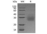 Recombinant Human HVEM/TNFRSF14 Protein (His Tag)