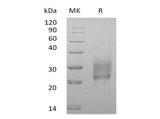 Recombinant Human HAI-2/SPINT2 Protein (His Tag)