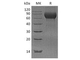 Recombinant Human Hemopexin/HPX Protein (His Tag)