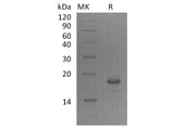 Recombinant Human GADD45A/DDIT-1 Protein (His Tag)