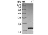 Recombinant Human G-CSF/CSF3 Protein Purity >95%