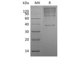 Recombinant Human Glypican 3/GPC3 Protein (His Tag)(Active)