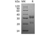 Recombinant Human CGA&CGB3 Heterodimer Protein (His & Flag Tag)