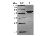 Recombinant Human GITR/TNFRSF18 Protein (mFc Tag)