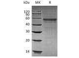 Recombinant Human GLP1R Protein (Fc Tag)