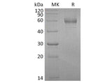 Recombinant Human GFRA1/GDNFRA Protein (aa 25-429, His Tag)(Active)