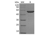 Recombinant Human NSE/ENO2 Protein (His Tag)