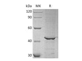 Recombinant Human GALK1/Galactokinase Protein (His Tag)