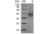 Recombinant Human Follistatin 288/FST Protein