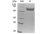 Recombinant Human FLRT1 Protein (His Tag)