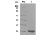 Recombinant Human Fibronectin/FN Protein (His & Avi Tag)