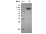 Recombinant Human FGFR3/CD333 Protein (Fc Tag)(Active)