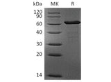 Recombinant Human FGL1 Protein (mFc Tag)(Active)