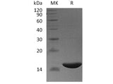 Recombinant Human FABP6/I-BABP Protein (His Tag)