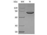 Recombinant Human Ezrin/EZR Protein