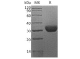 Recombinant Human Erythropoietin R/EPOR Protein (His Tag)