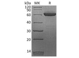 Recombinant Human Erythropoietin R/EPOR Protein (Fc Tag)