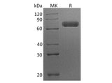 Recombinant Human EphA7/EHK3 Protein (His Tag)(Active)