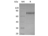 Recombinant Human EphA1 Protein (His Tag)