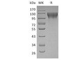 Recombinant Human ECE1 Protein (His Tag)