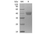 Recombinant Human ESAM Protein (aa 30-247, His Tag)