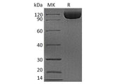 Recombinant Human DPP4/DPPIV/CD26 Protein (His Tag)