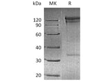 Recombinant Human DPP4/DPPIV/CD26 Protein (Fc Tag)