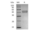 Recombinant Human DKK1/Dkk-1 Protein (His Tag)