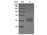 Recombinant Human CTLA4 Protein (His Tag)(Active)