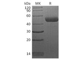 Recombinant Human CTLA4 Protein (mFc Tag)