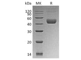 Recombinant Human CTLA4 Protein (GST Tag)