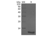 Recombinant Human CXCL2/MIP-2 Protein