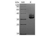 Recombinant Human Langerin/CD207 Protein (His Tag)