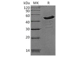 Recombinant Human Creatine Kinase BB/CKB Protein (His Tag)