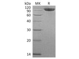 Recombinant Human CFHR4 Protein (His Tag)