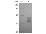 Recombinant Human CFHR3 Protein (His Tag)