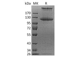 Recombinant Human COL21A1 Protein (His Tag)